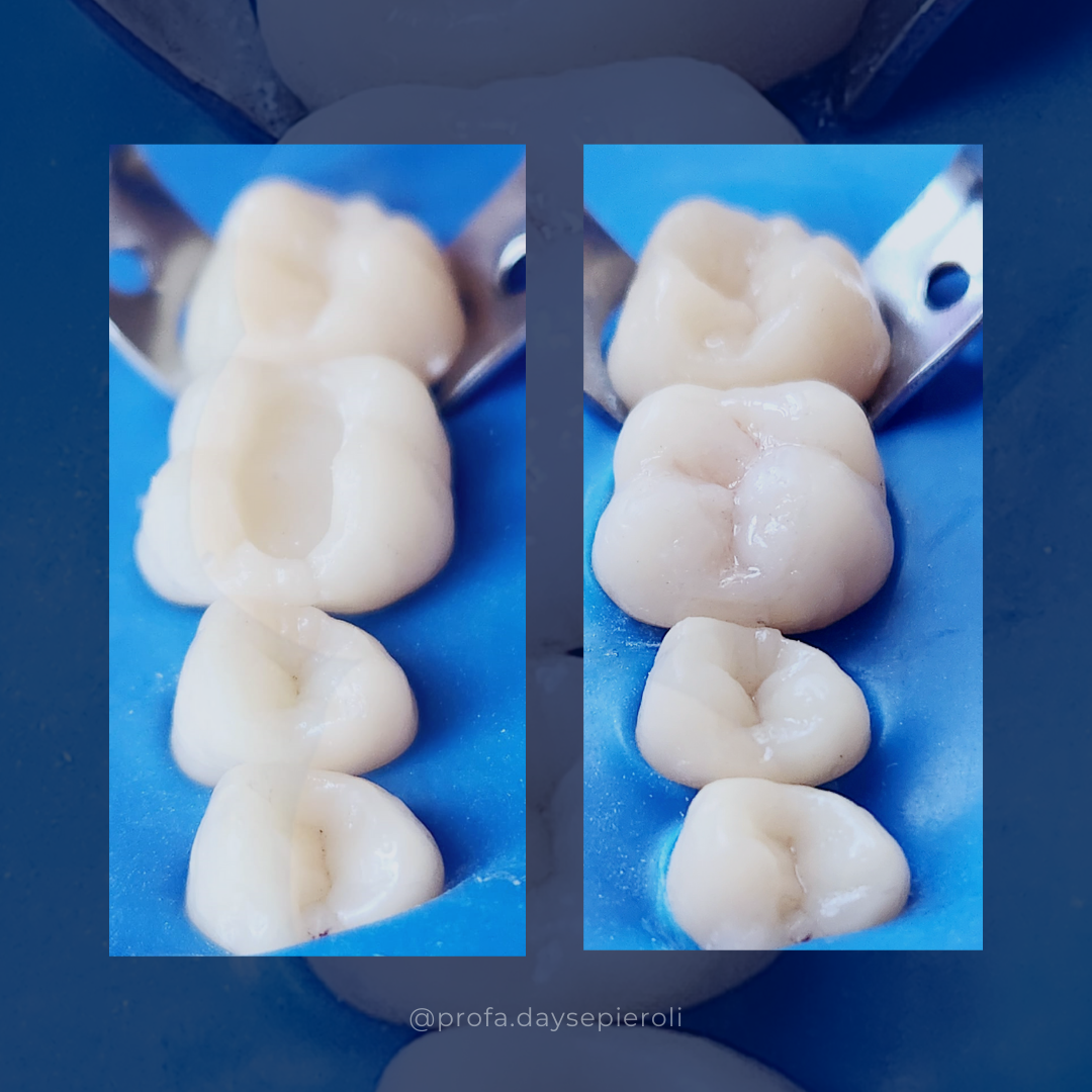 Quais procedimentos e técnicas estão dentro do conceito de odontologia biomimética?